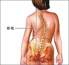 脊柱畸形要掌握正確的護理方式