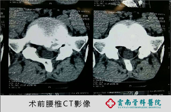 術前CT